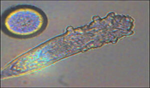 How I Fixed Dry Eyes with a Diluted Tea Tree Oil Eyebrow Scrub