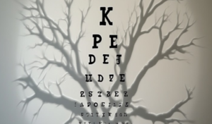 Why I Can See My Own Eye Veins: The Purkinje Tree Phenomenon